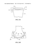 Surgical Tools for Arthroplasty diagram and image