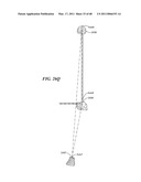 Surgical Tools for Arthroplasty diagram and image