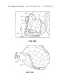 Surgical Tools for Arthroplasty diagram and image