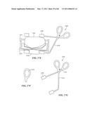 Surgical Tools for Arthroplasty diagram and image