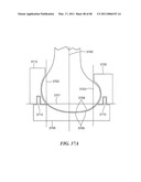 Surgical Tools for Arthroplasty diagram and image