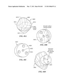 Surgical Tools for Arthroplasty diagram and image