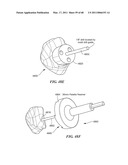 Surgical Tools for Arthroplasty diagram and image