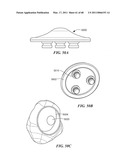 Surgical Tools for Arthroplasty diagram and image