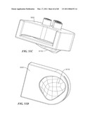 Surgical Tools for Arthroplasty diagram and image