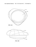 Surgical Tools for Arthroplasty diagram and image