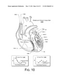 ELECTRODE AND LEAD STABILITY INDEXES AND STABILITY MAPS BASED ON LOCALIZATION SYSTEM DATA diagram and image