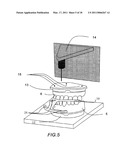 SURGICAL GUIDES AND METHODS FOR POSITIONING ARTIFICIAL TEETH AND DENTAL IMPLANTS diagram and image