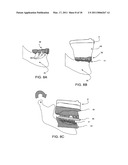 SURGICAL GUIDES AND METHODS FOR POSITIONING ARTIFICIAL TEETH AND DENTAL IMPLANTS diagram and image