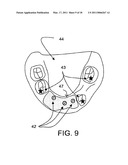 SURGICAL GUIDES AND METHODS FOR POSITIONING ARTIFICIAL TEETH AND DENTAL IMPLANTS diagram and image