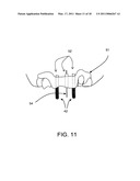 SURGICAL GUIDES AND METHODS FOR POSITIONING ARTIFICIAL TEETH AND DENTAL IMPLANTS diagram and image