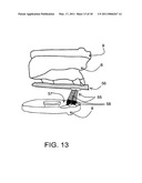 SURGICAL GUIDES AND METHODS FOR POSITIONING ARTIFICIAL TEETH AND DENTAL IMPLANTS diagram and image