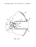 BIRD FEEDER diagram and image