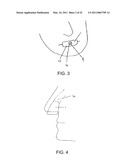 NASAL RESPIRATORY DEVICES diagram and image