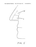 NASAL RESPIRATORY DEVICES diagram and image