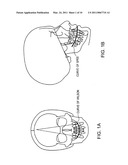 NIGHT TIME DENTAL PROTECTOR diagram and image