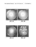 Method for Magnetic Resonance Imaging diagram and image