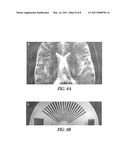 Method for Magnetic Resonance Imaging diagram and image