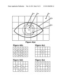 Two Stage Detection For Photographic Eye Artifacts diagram and image