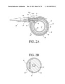 IMPLANTABLE RESTRICTION SYSTEM WITH RELEASE MECHANISM diagram and image