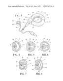 IMPLANTABLE RESTRICTION SYSTEM WITH RELEASE MECHANISM diagram and image