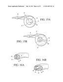 IMPLANTABLE RESTRICTION SYSTEM WITH RELEASE MECHANISM diagram and image