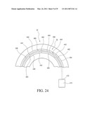 IMPLANTABLE RESTRICTION SYSTEM WITH RELEASE MECHANISM diagram and image