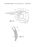 IMPLANTABLE RESTRICTION SYSTEM WITH RELEASE MECHANISM diagram and image