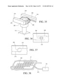 IMPLANTABLE RESTRICTION SYSTEM WITH RELEASE MECHANISM diagram and image