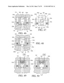 IMPLANTABLE RESTRICTION SYSTEM WITH RELEASE MECHANISM diagram and image