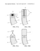 IMPLANTABLE RESTRICTION SYSTEM WITH RELEASE MECHANISM diagram and image