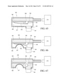 IMPLANTABLE RESTRICTION SYSTEM WITH RELEASE MECHANISM diagram and image