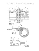 IMPLANTABLE RESTRICTION SYSTEM WITH RELEASE MECHANISM diagram and image