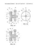 IMPLANTABLE RESTRICTION SYSTEM WITH RELEASE MECHANISM diagram and image