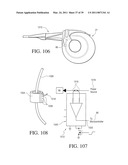 IMPLANTABLE RESTRICTION SYSTEM WITH RELEASE MECHANISM diagram and image