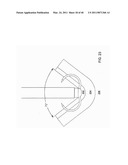 Tissue Retractor and Method for Using the Retractor diagram and image