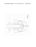 Tissue Retractor and Method for Using the Retractor diagram and image