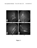 FUNCTIONAL NEAR-INFRARED FLUORESCENCE LYMPHATIC MAPPING FOR DIAGNOSING, ACCESSING, MONITORING AND DIRECTING THERAPY OF LYMPHATIC DISORDERS diagram and image