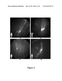 FUNCTIONAL NEAR-INFRARED FLUORESCENCE LYMPHATIC MAPPING FOR DIAGNOSING, ACCESSING, MONITORING AND DIRECTING THERAPY OF LYMPHATIC DISORDERS diagram and image