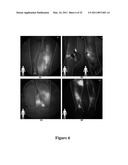 FUNCTIONAL NEAR-INFRARED FLUORESCENCE LYMPHATIC MAPPING FOR DIAGNOSING, ACCESSING, MONITORING AND DIRECTING THERAPY OF LYMPHATIC DISORDERS diagram and image