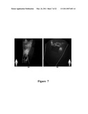 FUNCTIONAL NEAR-INFRARED FLUORESCENCE LYMPHATIC MAPPING FOR DIAGNOSING, ACCESSING, MONITORING AND DIRECTING THERAPY OF LYMPHATIC DISORDERS diagram and image