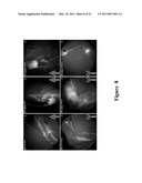 FUNCTIONAL NEAR-INFRARED FLUORESCENCE LYMPHATIC MAPPING FOR DIAGNOSING, ACCESSING, MONITORING AND DIRECTING THERAPY OF LYMPHATIC DISORDERS diagram and image