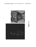 FUNCTIONAL NEAR-INFRARED FLUORESCENCE LYMPHATIC MAPPING FOR DIAGNOSING, ACCESSING, MONITORING AND DIRECTING THERAPY OF LYMPHATIC DISORDERS diagram and image