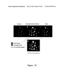 FUNCTIONAL NEAR-INFRARED FLUORESCENCE LYMPHATIC MAPPING FOR DIAGNOSING, ACCESSING, MONITORING AND DIRECTING THERAPY OF LYMPHATIC DISORDERS diagram and image