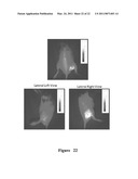 FUNCTIONAL NEAR-INFRARED FLUORESCENCE LYMPHATIC MAPPING FOR DIAGNOSING, ACCESSING, MONITORING AND DIRECTING THERAPY OF LYMPHATIC DISORDERS diagram and image