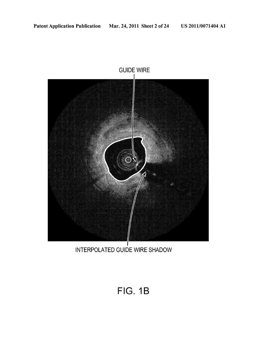 Lumen Morphology and Vascular Resistance Measurements Data Collection Systems, Apparatus and Methods - diagram, schematic, and image 03