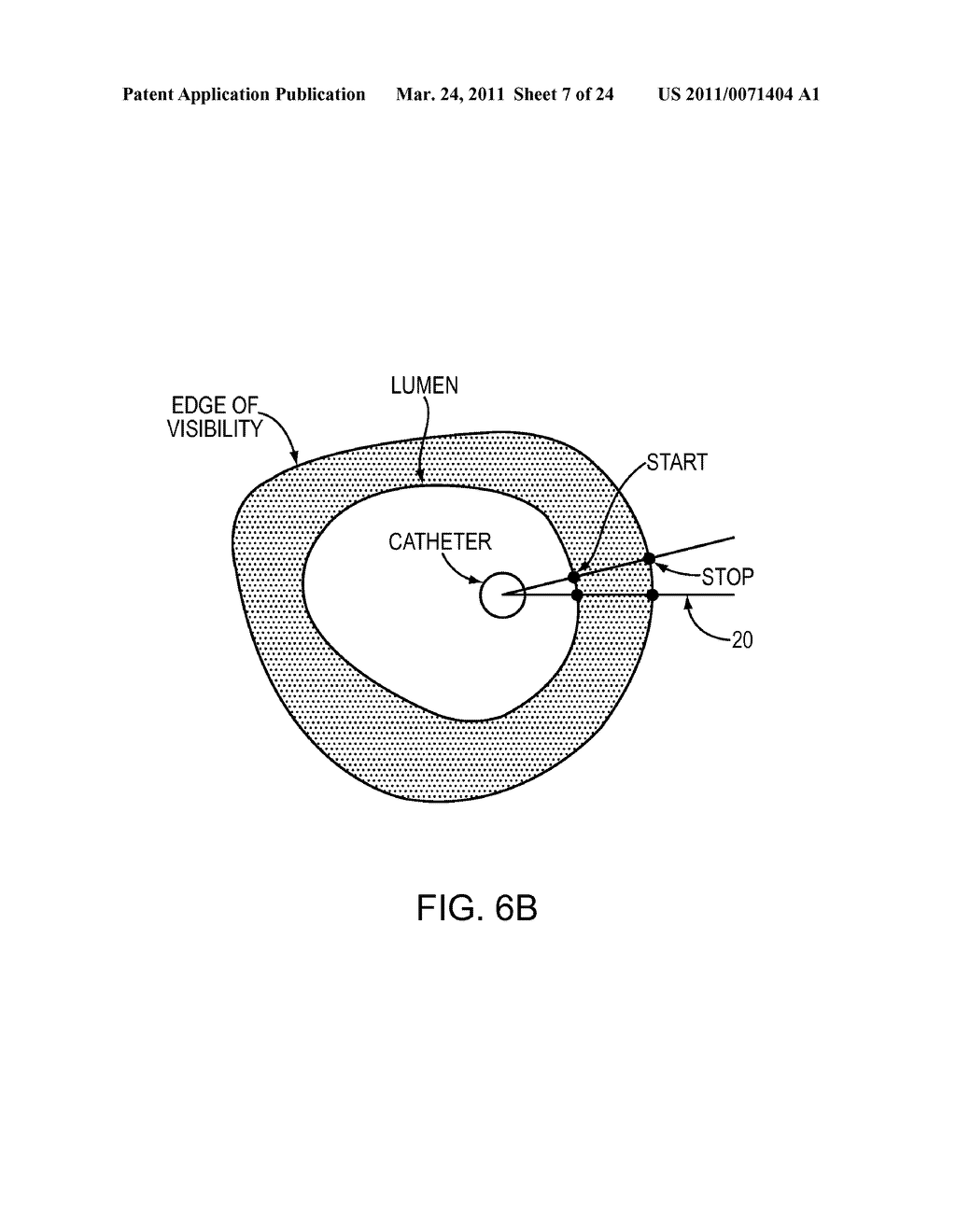 Lumen Morphology and Vascular Resistance Measurements Data Collection Systems, Apparatus and Methods - diagram, schematic, and image 08