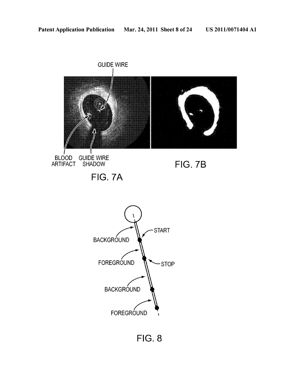 Lumen Morphology and Vascular Resistance Measurements Data Collection Systems, Apparatus and Methods - diagram, schematic, and image 09