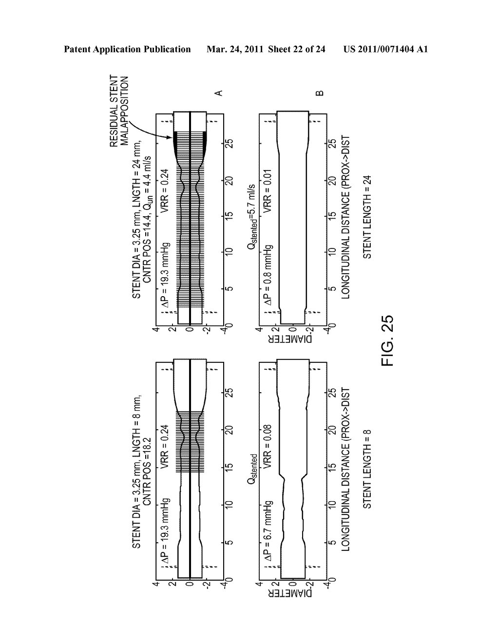 Lumen Morphology and Vascular Resistance Measurements Data Collection Systems, Apparatus and Methods - diagram, schematic, and image 23