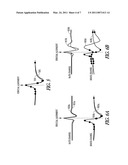 MORPHOLOGY BASED ISCHEMIA DETECTION USING INTRACARDIAC ELECTROGRAMS diagram and image